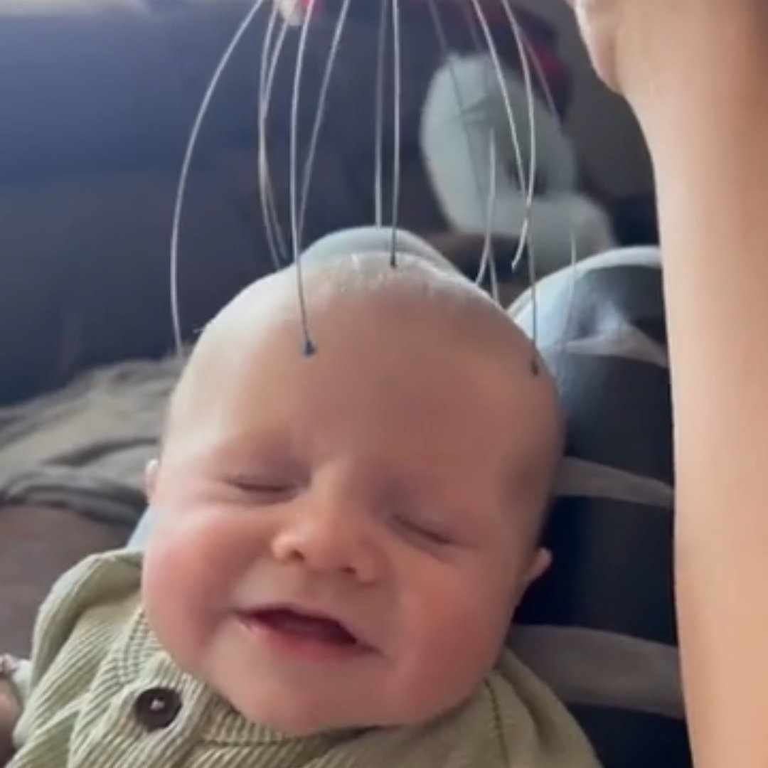 Read more about the article USAGA Head Massager Scalp Massager